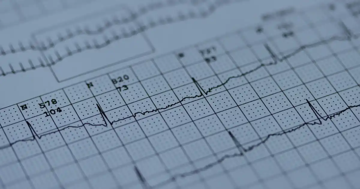 кардиолог София медива